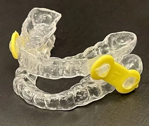 Picture of Elastic Mandibular Advancement (EMA) device for sleep apnea treatment