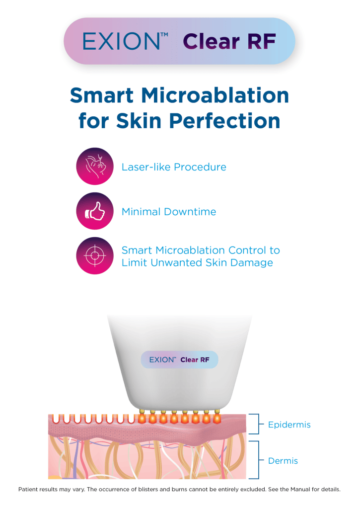 Image of microblation being performed on skin